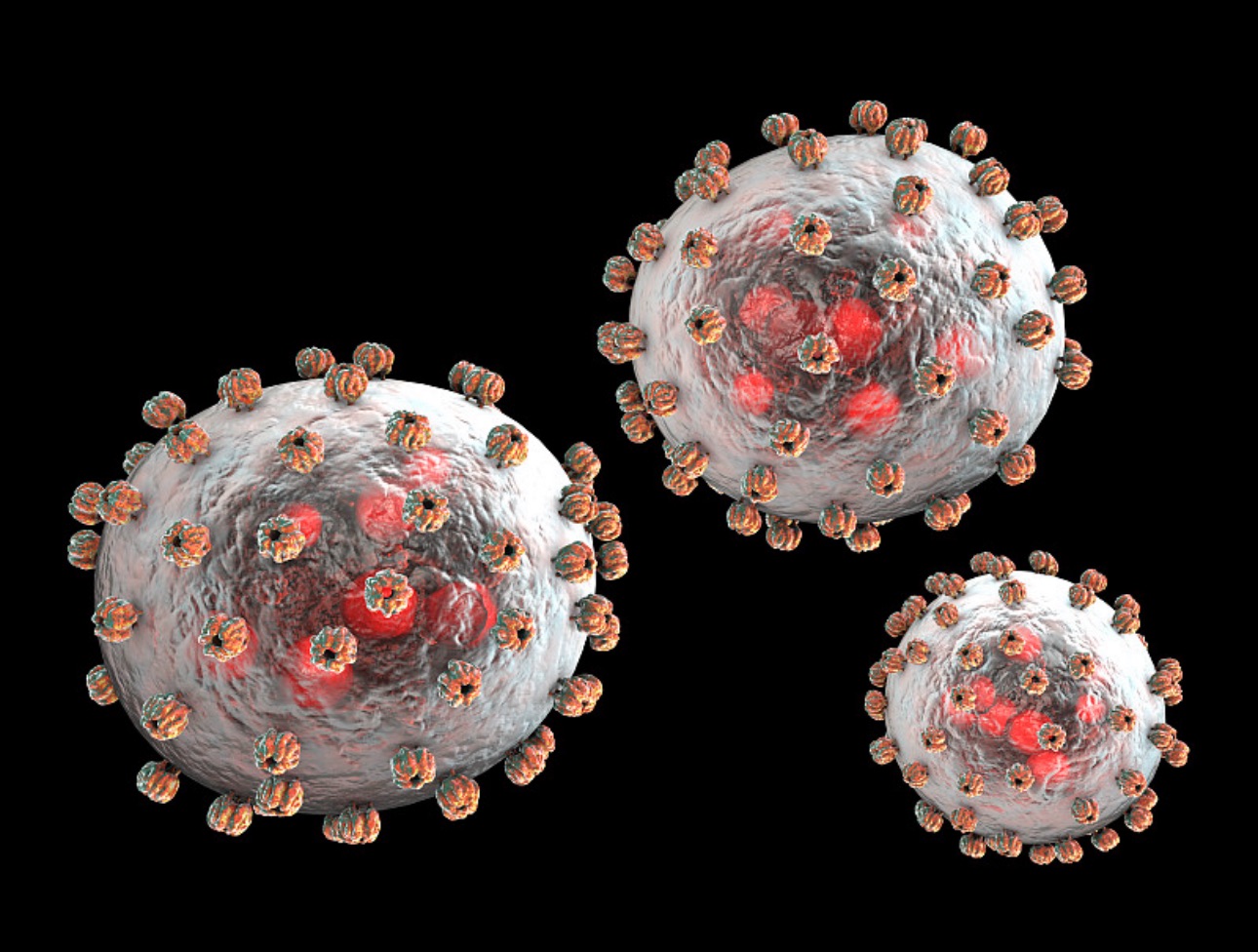 Lassa fever in Nigeria